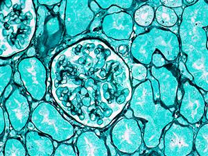 4055A | Control Slides:Histopathology; Basement Membrane